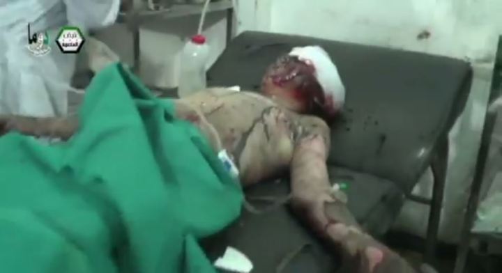 τραυματισμένο παιδί