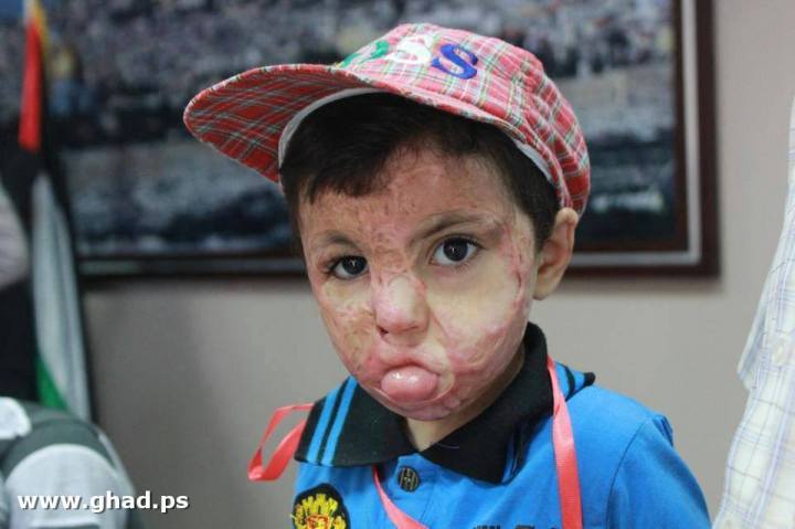 ΤΑ ΠΑΙΔΙΑ ΤΗΣ ΓΑΖΑΣ