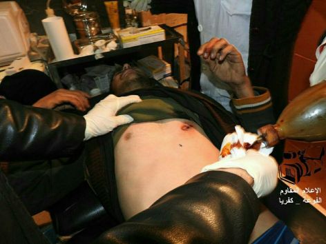 15894243_1205922069491258_5438899131856147040_n