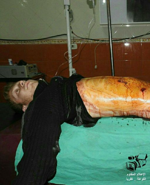 15965188_1205922126157919_1013072361020119119_n